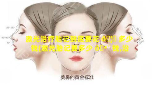 激光治疗胎记到底要花 🦄 多少钱(激光胎记要多少 🪴 钱,治疗方法有哪些)